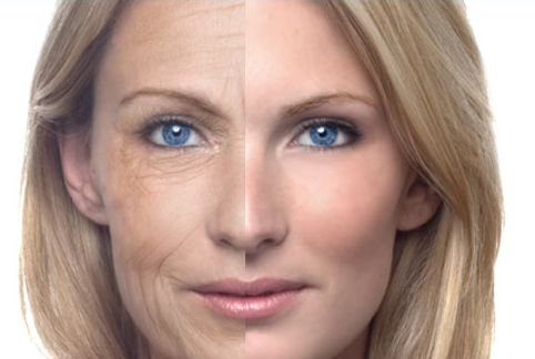 Age Defying Laser Technology